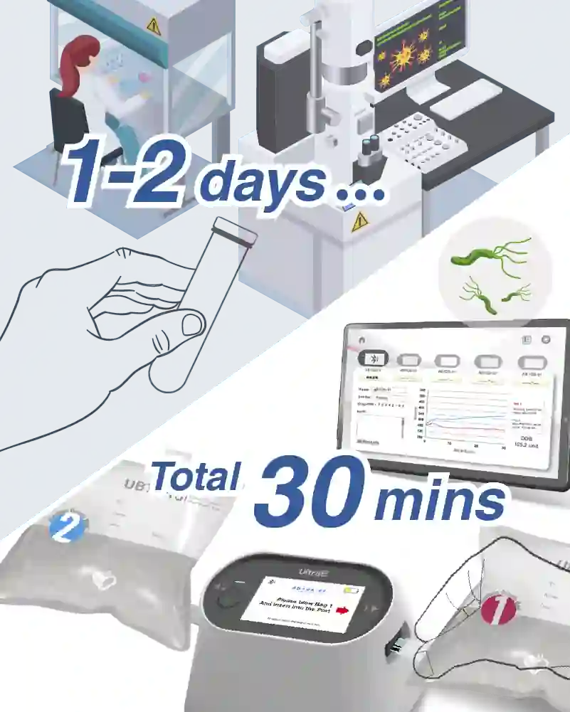 Comparison of detection time between UltraPeace and C13/14 H. pylori urea breath test methods - UltraE