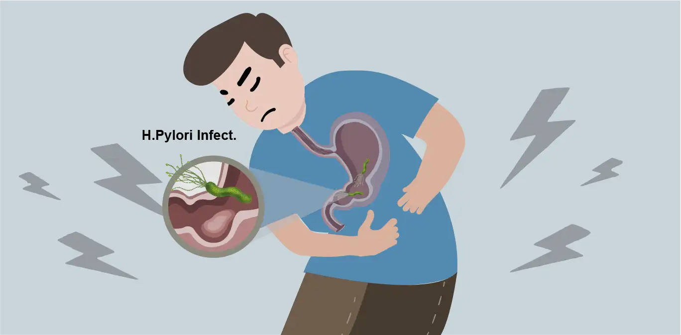 What is H. pylori and its pathogenic causes - UltraPeace/UltraE