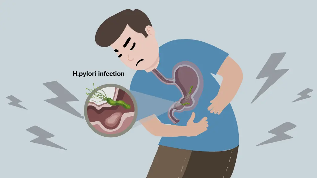 What is H. pylori and its pathogenic causes - UltraPeace/UltraE