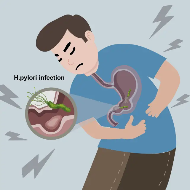 What is H. pylori and its pathogenic causes - UltraPeace/UltraE